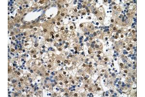 SQLE antibody was used for immunohistochemistry at a concentration of 4-8 ug/ml. (SQLE antibody  (C-Term))