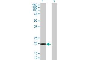 Western Blot analysis of CETN1 expression in transfected 293T cell line by CETN1 MaxPab polyclonal antibody.