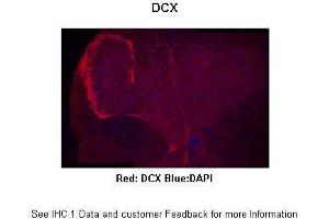 Sample Type :  Mouse spinal cord  Primary Antibody Dilution :  1:300  Secondary Antibody :  Anti-rabbit-Alexa 594  Secondary Antibody Dilution :  1:500  Color/Signal Descriptions :  Red: DCX Blue:DAPI  Gene Name :  DCX  Submitted by :  Anonymous (Doublecortin antibody  (C-Term))