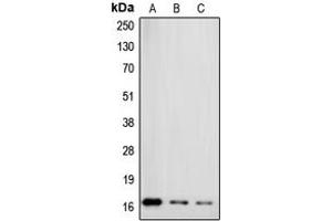 Western blot analysis of Gamma-synuclein expression in MCF7 (A), HT29 (B), HeLa (C) whole cell lysates. (SNCG antibody  (C-Term))