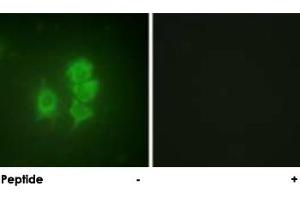 Immunofluorescence analysis of HUVEC cells, using RPS6KA5 polyclonal antibody . (MSK1 antibody)