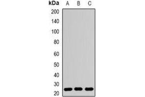 Western blot analysis of RAB5A expression in Hela (A), PC12 (B), mouse brain (C) whole cell lysates. (RAB5 antibody)