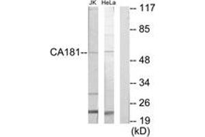 Western blot analysis of extracts from Jurkat/HeLa cells, using CA181 Antibody. (CA181 (AA 301-350) antibody)