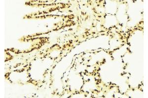 ABIN6273091 at 1/100 staining Mouse lung tissue by IHC-P. (ALDH7A1 antibody  (C-Term))