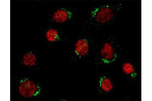 Immunocytochemistry (ICC) image for anti-Jumonji Domain Containing 6 (JMJD6) antibody (ABIN1742540)