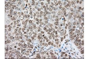 Immunohistochemical staining of paraffin-embedded Human colon tissue using anti-CYP1A2 mouse monoclonal antibody.