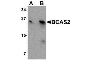Western blot analysis of BCAS2 in MCF7 cell lysate with AP30126PU-N BCAS2 antibody at (A) 0. (BCAS2 antibody  (C-Term))