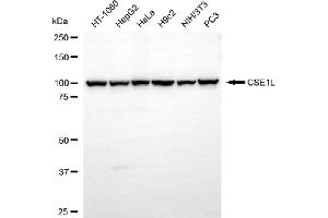 Western blotting analysis using CSE1L antibody (ABIN7798171).