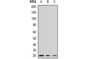 Western blot analysis of Alpha-crystallin A expression in mouse kidney (A), mouse liver (B), mouse heart (C) whole cell lysates. (CRYAA antibody)