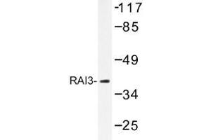 Image no. 1 for anti-G Protein-Coupled Receptor, Family C, Group 5, Member A (GPRC5A) antibody (ABIN317865) (GPRC5A antibody)