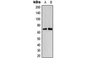 Western blot analysis of Estrogen Receptor alpha (pS118) expression in MCF7 EGF-treated (A), HeLa EGF-treated (B) whole cell lysates. (Estrogen Receptor alpha antibody  (pSer118))