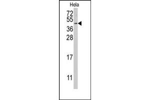 Image no. 1 for anti-Replication Factor C (Activator 1) 5, 36.5kDa (RFC5) (Middle Region) antibody (ABIN357979) (RFC5 antibody  (Middle Region))