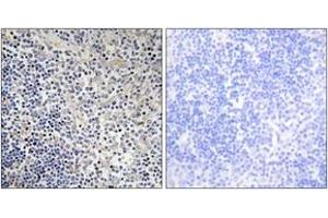 Immunohistochemistry (IHC) image for anti-P53-Regulated Apoptosis-Inducing Protein 1 (TP53AIP1) (AA 75-124) antibody (ABIN2890029) (TP53AIP1 antibody  (AA 75-124))