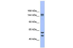 WB Suggested Anti-FBXL10 Antibody Titration: 0. (KDM2B antibody  (Middle Region))