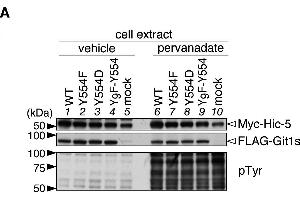 Git1 phosphorylation at Tyr-554 weakened its association with Hic-5. (Myc Tag antibody)