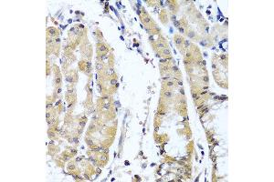 Immunohistochemistry of paraffin-embedded human stomach using COL9A1 antibody at dilution of 1:100 (40x lens). (COL9A1 antibody)