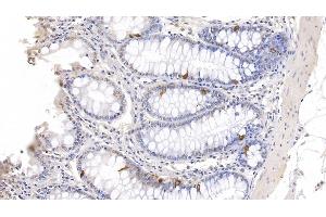 Immunohistochemistry (IHC) image for anti-Chromogranin A (CHGA) (AA 17-446) antibody (ABIN7443740)