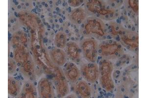 DAB staining on IHC-P; Samples: Rat Kidney Tissue (CUBN antibody  (AA 3511-3623))