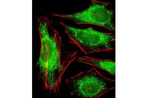 Fluorescent image of Hela cells stained with PPP2R2A Antibody (N-term). (PPP2R2A antibody  (N-Term))