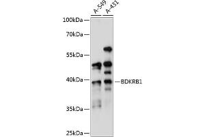 Western blot analysis of extracts of various cell lines, using BDKRB1 antibody (ABIN7265910) at 1:1000 dilution. (BDKRB1 antibody  (AA 1-100))