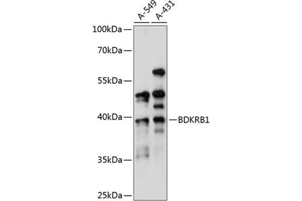 BDKRB1 抗体  (AA 1-100)