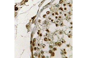 Immunohistochemical analysis of CIRBP staining in human testis formalin fixed paraffin embedded tissue section. (CIRBP antibody)