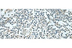 Immunohistochemistry of paraffin-embedded Human tonsil tissue using SHTN1 Polyclonal Antibody at dilution of 1:60(x200)