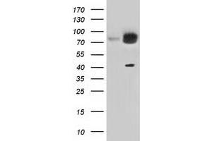 HEK293T cells were transfected with the pCMV6-ENTRY control (Left lane) or pCMV6-ENTRY KBTBD7 (Right lane) cDNA for 48 hrs and lysed. (KBTBD7 antibody)