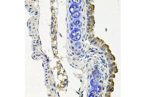 Immunohistochemistry of paraffin-embedded mouse lung using MARK1 antibody at dilution of 1:100 (x40 lens). (MARK1 antibody)