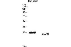 Western Blot (WB) analysis of Rat barin lysis using CD201 antibody. (PROCR antibody  (Internal Region))