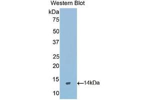 Detection of Recombinant GnRH, Rat using Polyclonal Antibody to Gonadotropin Releasing Hormone (GnRH) (GNRH1 antibody  (AA 25-92))