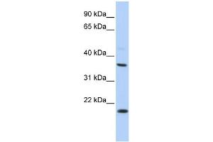 Western Blotting (WB) image for anti-Potassium Large Conductance Calcium-Activated Channel, Subfamily M beta Member 3 (KCNMB3) (Middle Region) antibody (ABIN2776296)