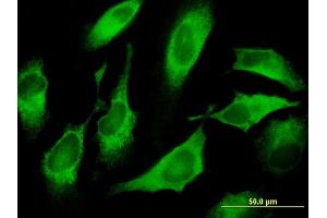 Immunofluorescence of monoclonal antibody to CDS1 on HeLa cell. (CDS1 antibody  (AA 1-98))
