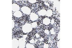Immunohistochemical staining of human bone marrow with ZNF589 polyclonal antibody  shows strong nuclear positivity in bone marrow poietic cells. (ZNF589 antibody)