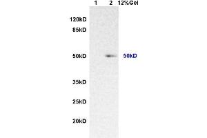 Lane 1: rat lung lysates Lane 2: human colon carcinomalysates probed with AntiIL-7Ra/CD127 Polyclonal Antibody, Unconjugated (ABIN731063) at 1:200 in 4 °C. (IL7R antibody  (AA 251-350))