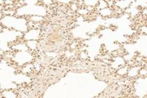 Immunohistochemistry analysis of paraffin-embedded rat lung using,TPRKB (ABIN7075943) at dilution of 1: 4200