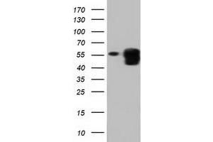 HEK293T cells were transfected with the pCMV6-ENTRY control (Left lane) or pCMV6-ENTRY PEPD (Right lane) cDNA for 48 hrs and lysed. (PEPD antibody)