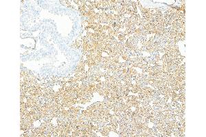 Immunohistochemistry (IHC) image for anti-Cadherin 5 (CDH5) (AA 25-595) antibody (ABIN7453992) (Recombinant Cadherin 5 antibody  (AA 25-595))