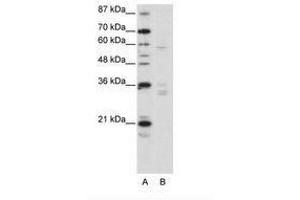 Image no. 1 for anti-Zinc Finger Protein 440 (ZNF440) (N-Term) antibody (ABIN203220)