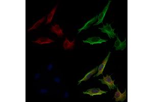 ABIN6264566 and ABIN6279733 staining 3 by IF/ICC.