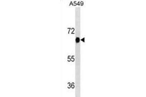 Western Blotting (WB) image for anti-Dual-Specificity tyrosine-(Y)-phosphorylation Regulated Kinase 2 (DYRK2) antibody (ABIN2995437) (DYRK2 antibody)