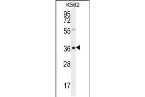 SLC25A31 anticorps  (AA 139-167)