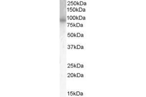 Image no. 1 for anti-phosphodiesterase 4B, cAMP-Specific (PDE4B) (C-Term) antibody (ABIN374649) (PDE4B antibody  (C-Term))