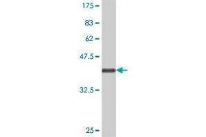 Western Blot detection against Immunogen (36. (TRIP6 antibody  (AA 51-148))