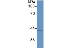 Western Blotting (WB) image for anti-serpin Peptidase Inhibitor, Clade B (Ovalbumin), Member 5 (SERPINB5) (AA 1-375) antibody (ABIN1869101)