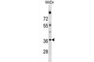 Western Blotting (WB) image for anti-Asparagine-Linked Glycosylation 5, Dolichyl-Phosphate beta-Glucosyltransferase Homolog (S. Cerevisiae) (ALG5) antibody (ABIN2999771) (ALG5 antibody)