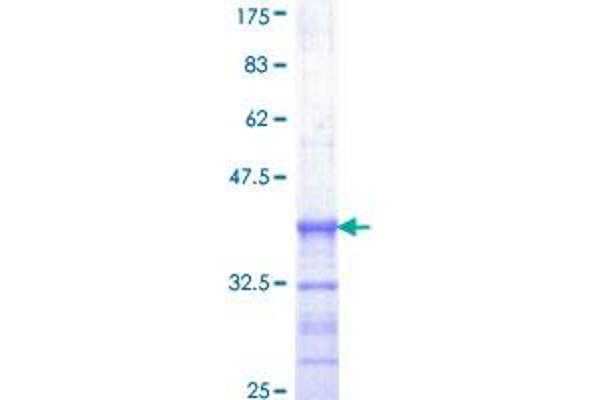 ELK1 Protein (AA 67-166) (GST tag)