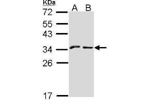 WB Image Sample (30 ug of whole cell lysate) A: A431 , B: Hep G2 , 12% SDS PAGE NKG2-A (CD159a) antibody antibody diluted at 1:1000 (KLRC1 antibody  (N-Term))