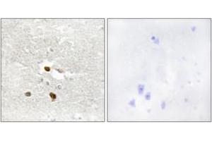 Immunohistochemistry analysis of paraffin-embedded human brain tissue, using ZNF287 Antibody. (ZNF287 antibody  (AA 241-290))