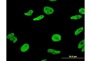 Immunofluorescence of monoclonal antibody to HNRNPA1 on HeLa cell. (HNRNPA1 antibody  (AA 1-320))